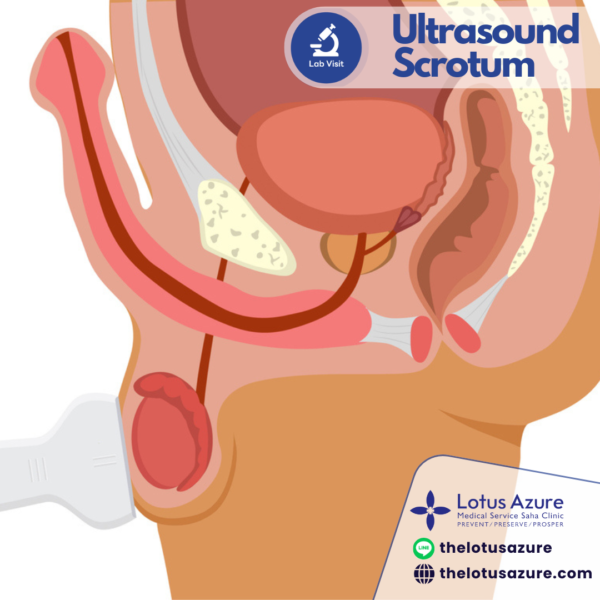 Ultrasound Scrotum