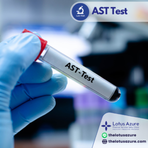 AST Test