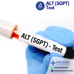 ALT (SGPT) Test