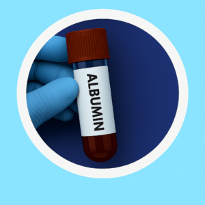 ALBUMIN