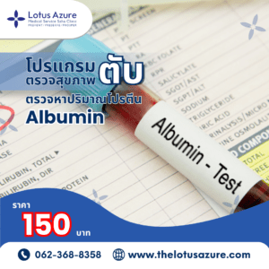 ALBUMIN
