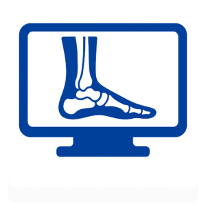 Ankle Xray (ข้อเท้า)