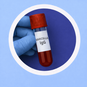 الأجسام المضادة للحماق النطاقي IgG