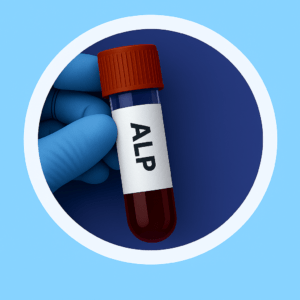 ALP (Alkaline phosphatase Test)