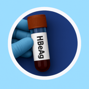HBeAg