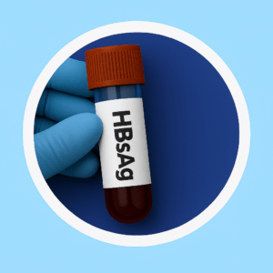 HBsAg