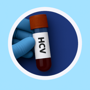 เอชซีวี (แอนตี้เอชซีวี)