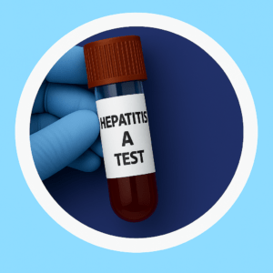 Hepatitis A(Anti-HAV)