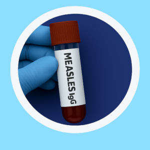 الأجسام المضادة IgG للحصبة