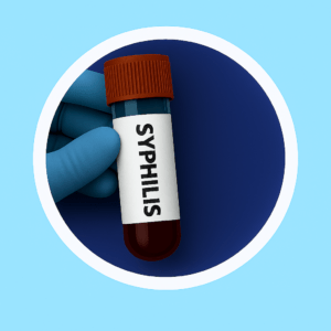 ซิฟิลิส (RPR)