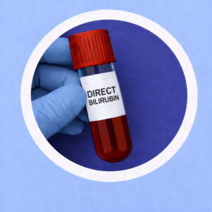 DIRECT BILIRUBIN