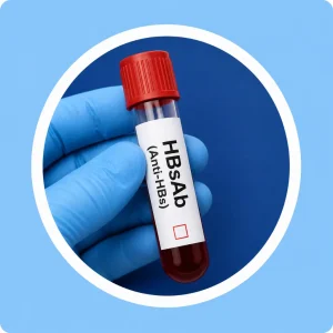 HBsAb (Anti-HBs)