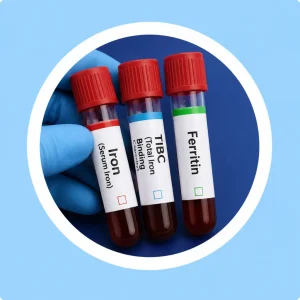 การตรวจระดับธาตุเหล็กในเลือด (Iron + TIBC + Ferritin)