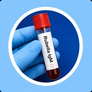 Rubella IgM