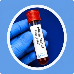 Allergy Test 37 Test (J149)