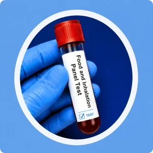 การตรวจหาภูมิแพ้อาหารและสารก่อภูมิแพ้ทางอากาศ