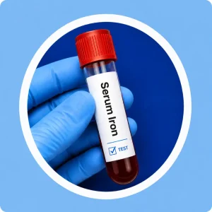 Serum Iron